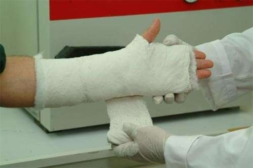 Hand and Finger Fracture Reparations 