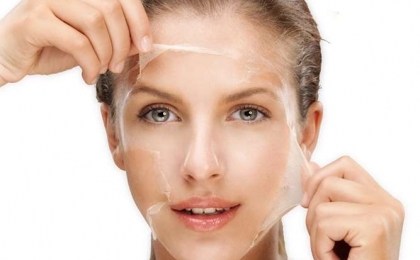 Facial Peeling with Acid