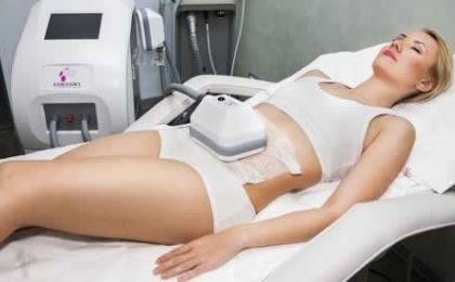 Coolsculpting